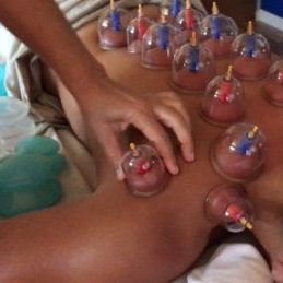 cupping2-cropped